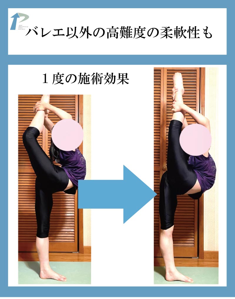 バレエ整体,東京,名古屋,柔軟性