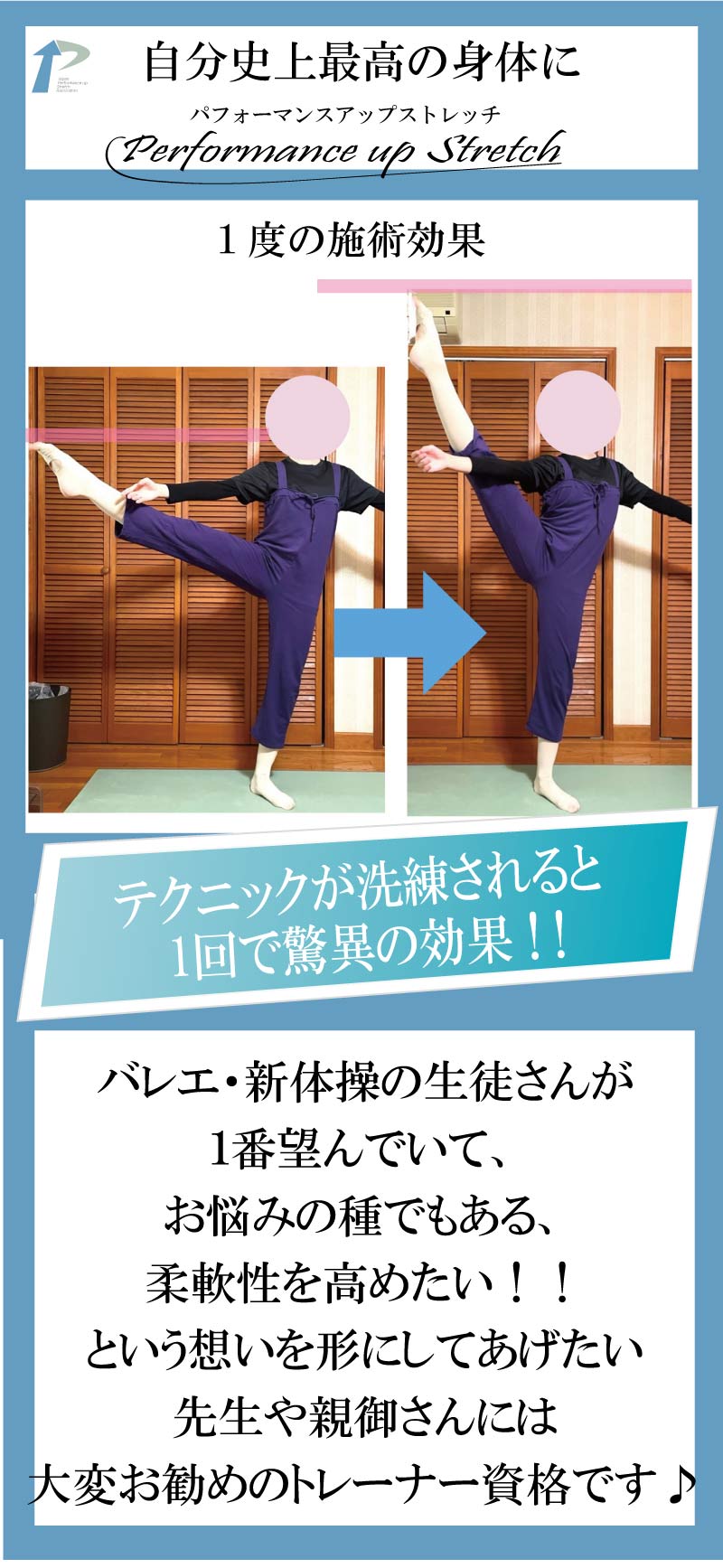 �o���G�p�t�H�[�}���X�A�b�v�X�g���b�`�g���[�i,�o���G,���i,�X�g���b�`