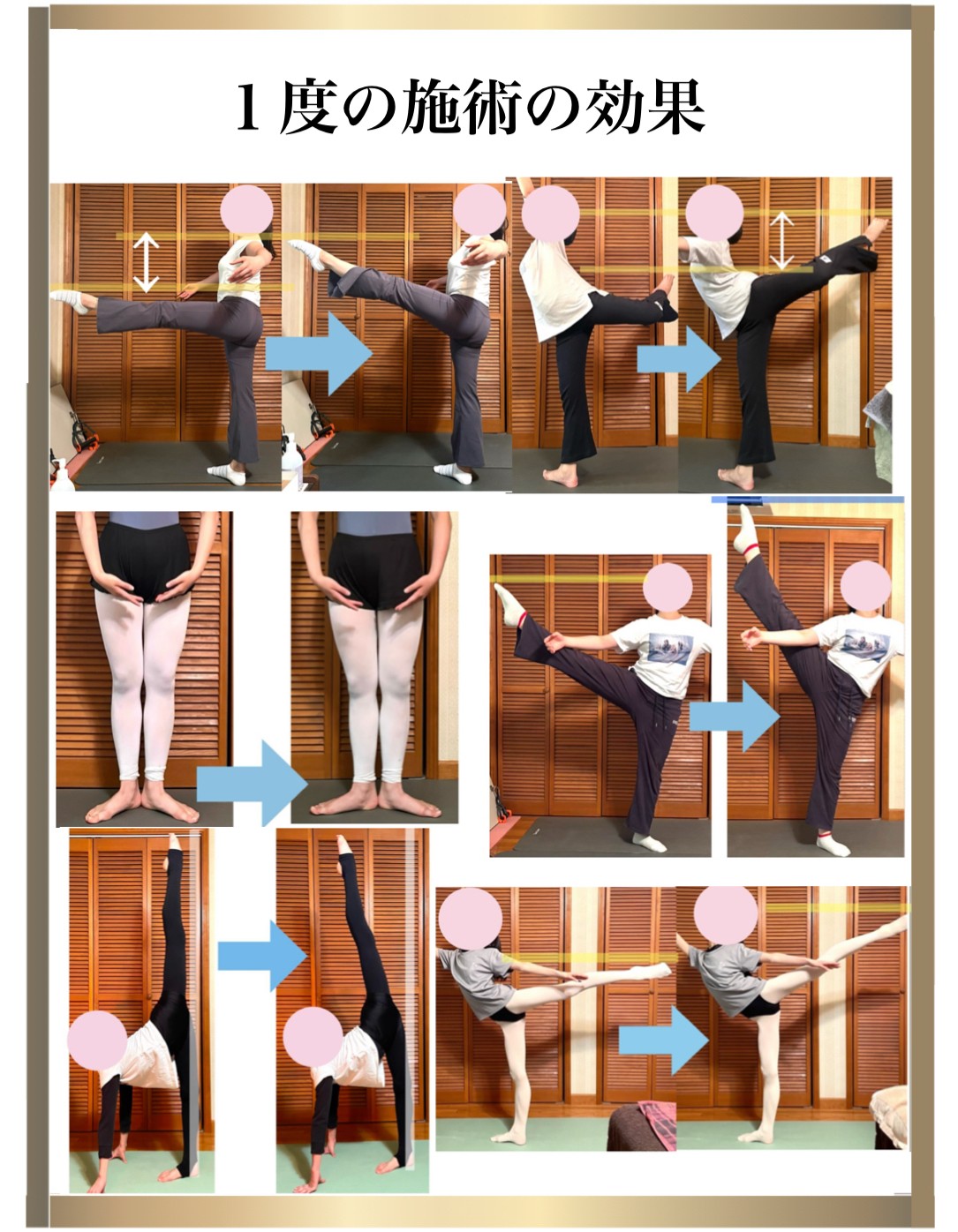 �o���G����,�_�,�g���[�i�[���i,one-on-one�t���L�V�r���e�B�X�g���b�`